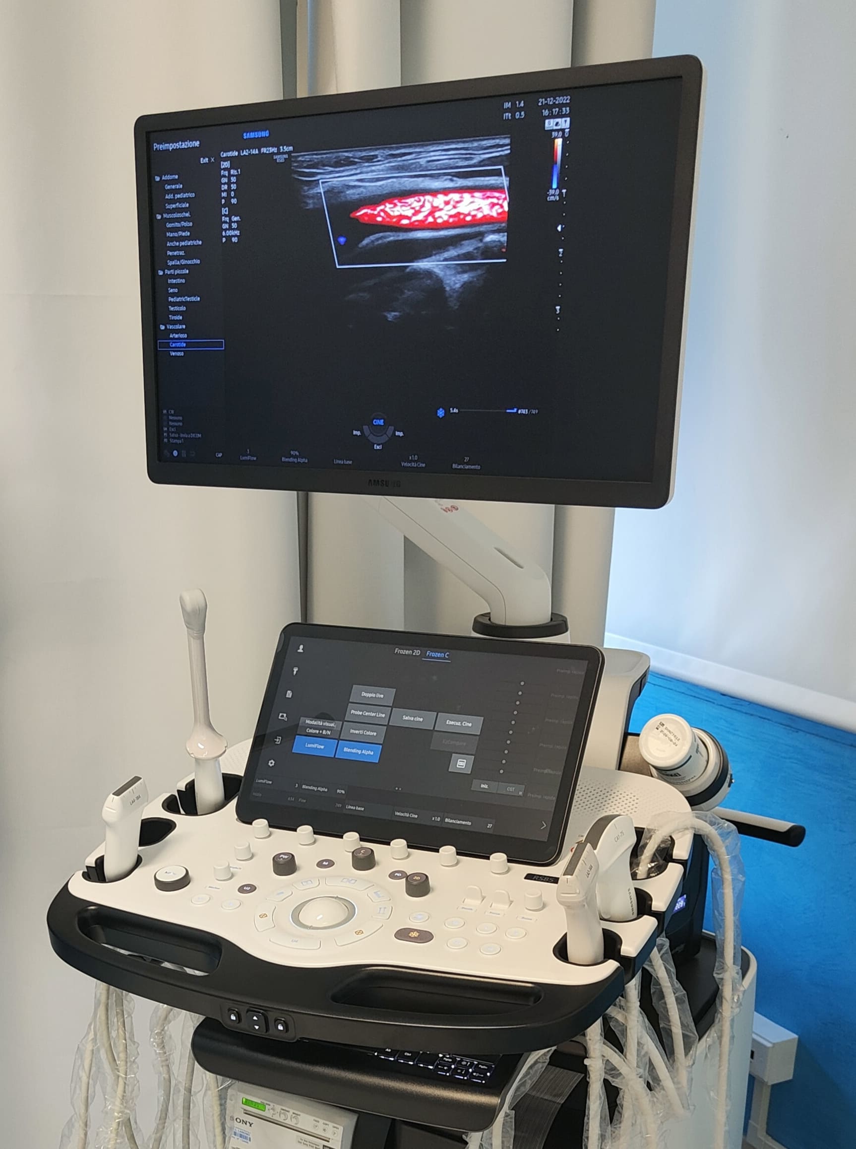 Nuovo ecografo Ospedale di Lanusei